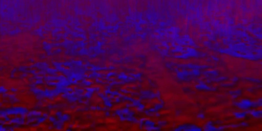 Anaesthesia at MUTEK MX 2018